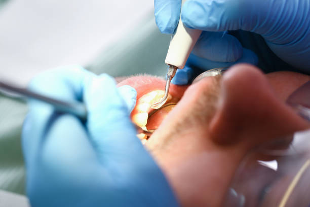 Best Pediatric Emergency Dentist in Watonga, OK