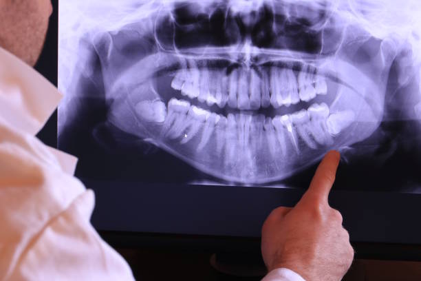 Best Emergency Tooth Extraction in Watonga, OK