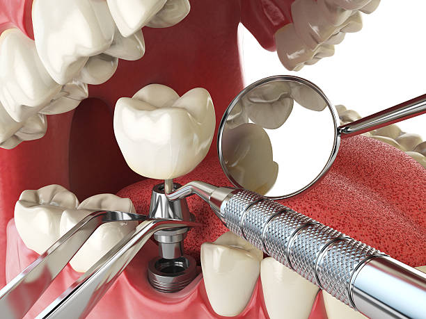 Best Emergency Treatment for Toothache in Watonga, OK